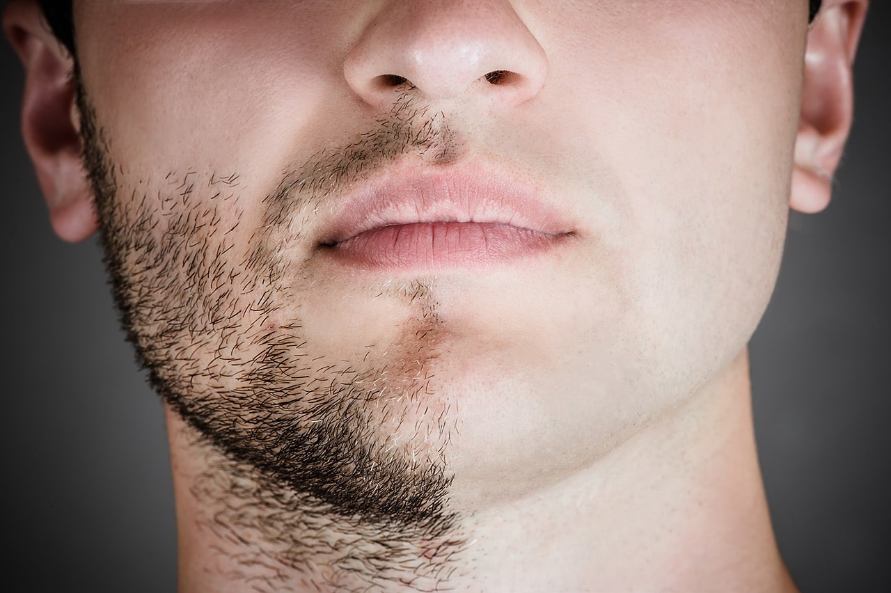 Comment Se Faire Pousser La Barbe Rapidement Masculin